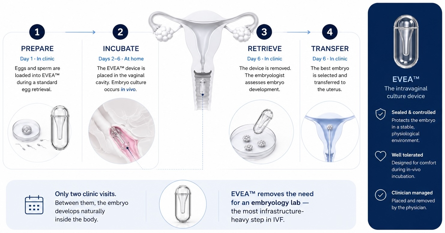 EVEA™ four-step process: Prepare, Incubate, Retrieve, Transfer